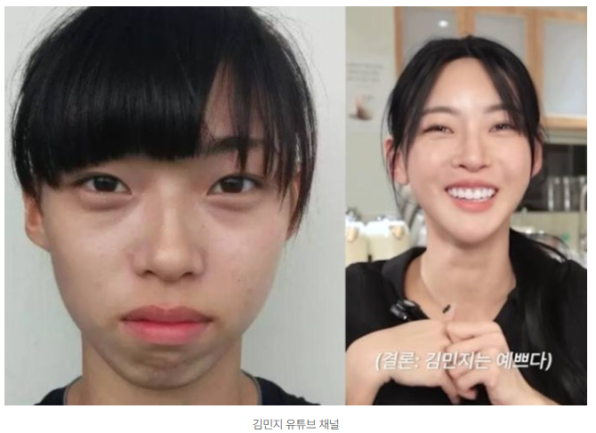 솔로지옥5 육상선수 김민지 성형 논란