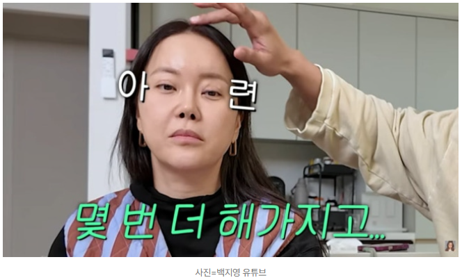 백지영 10억 성형설 부작용 고백