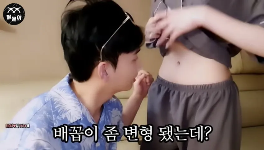 변형된 배꼽